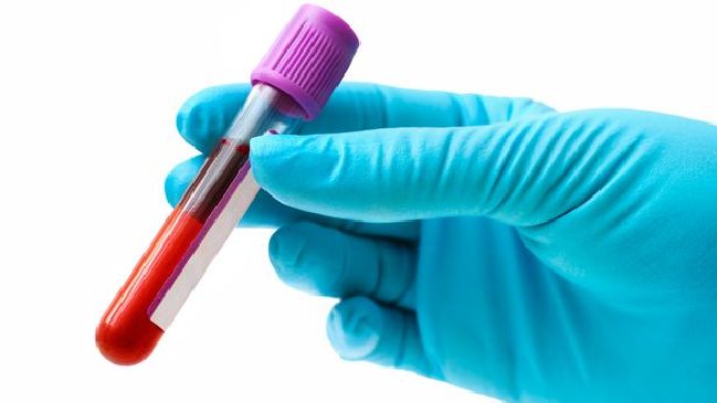 Nuevos avances para detectar cáncer de mama con prueba de sangre