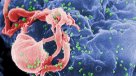Médicos detectaron el virus del Sida en una niña que se creía curada