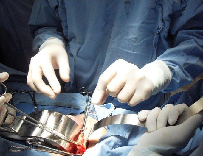 Pacientes de GIST piden que sistemas de salud ayuden a costear tratamientos