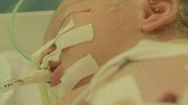 Falleció la bebé rescatada del vientre de su madre muerta en Gaza