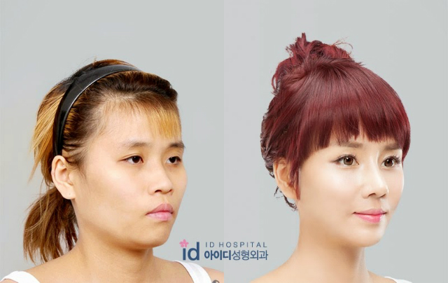 Imagen foto_00000015