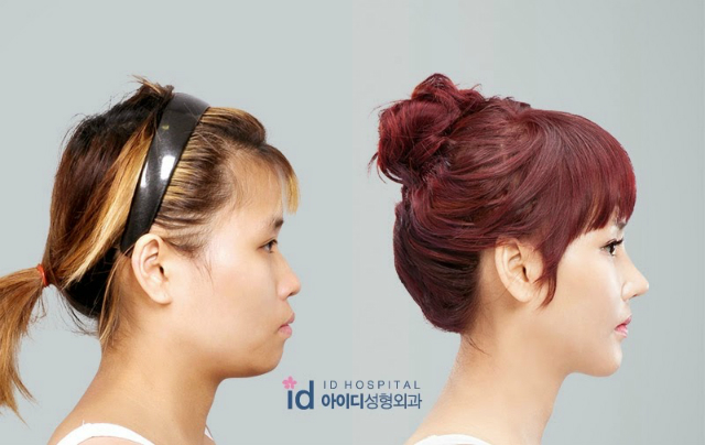 Imagen foto_00000016