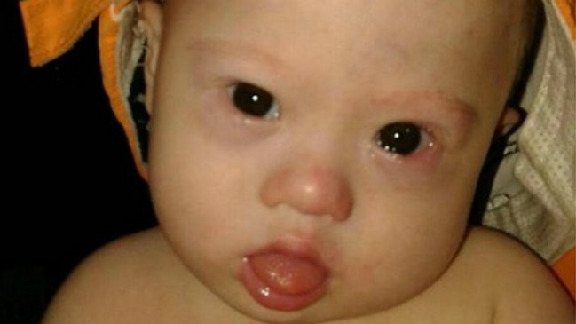 Pareja abandonó a hijo con síndrome de Down tras alquilar vientre