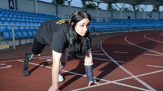 Joven británica quiere que le amputen una pierna para emular a Pistorius