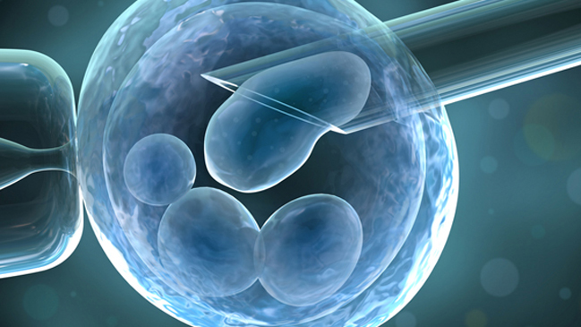 Nace en Suecia el primer bebé tras un trasplante de útero
