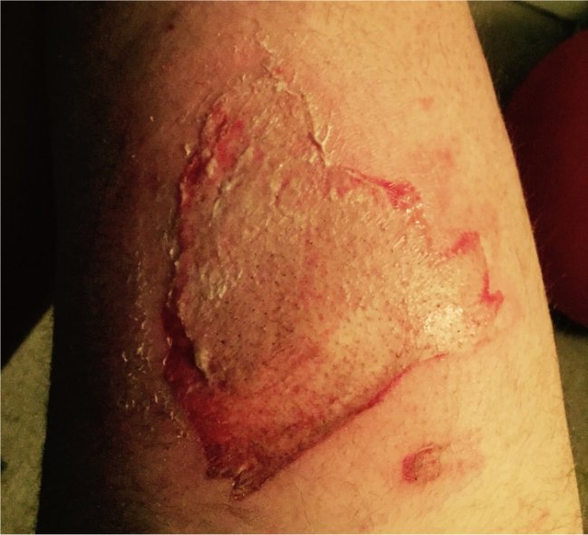 Imagen foto_00000001