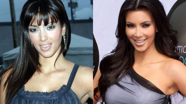 Imagen foto_00000004