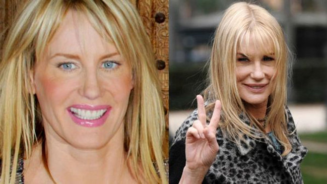 Imagen foto_00000010