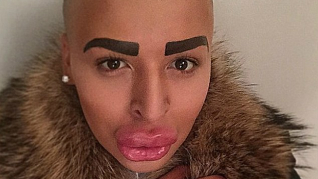 Joven de 23 años ha gastado 150 mil dólares para ser como Kim Kardashian