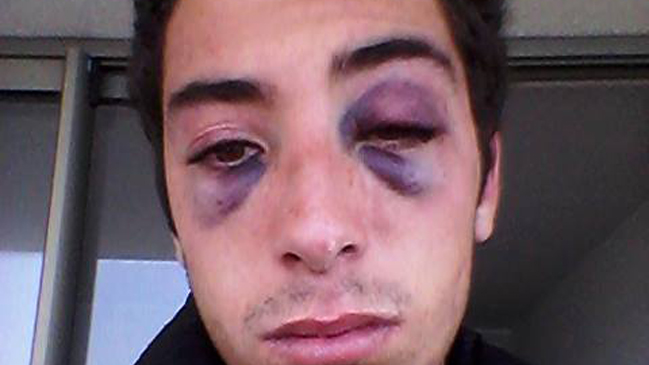 Joven acusó golpiza de su polola en Facebook