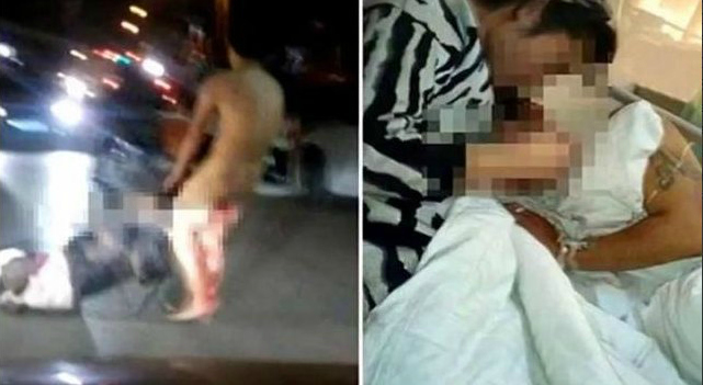 Mujer mutiló dos veces el pene de su marido tras descubrir infidelidad