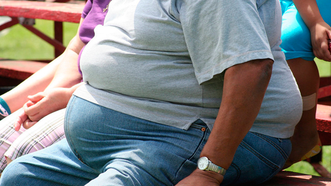 Mitos y verdades de las cirugías bariátricas