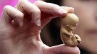 Matronas: Las instituciones de salud de la UC lo único que han hecho es lucrar