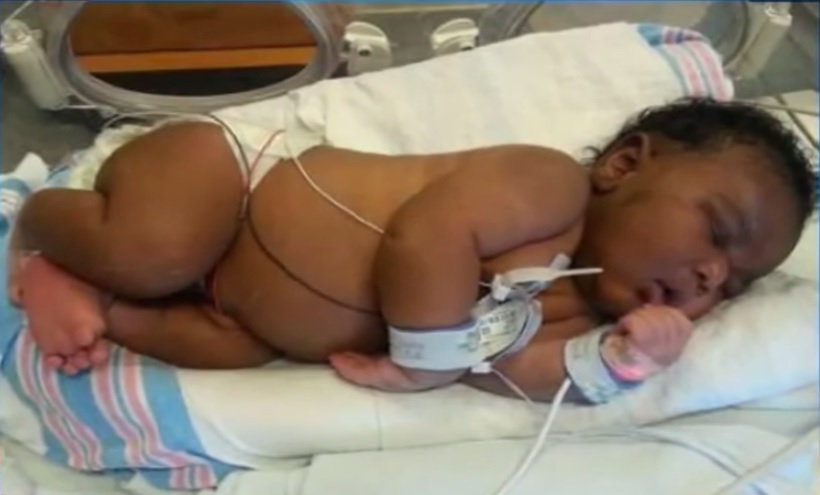 Mujer dio a luz un bebé de 6,4 kilos de peso