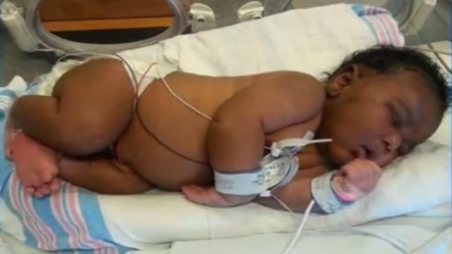 Mujer dio a luz un bebé de 6,4 kilos de peso