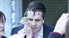 EEUU condenó ataque armado contra su embajador en Seúl