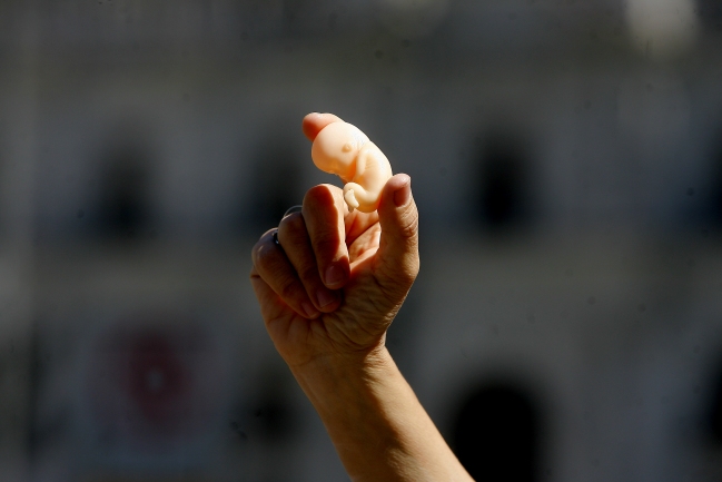 Consulta: Más de la mitad de los médicos está a favor de legislar sobre aborto