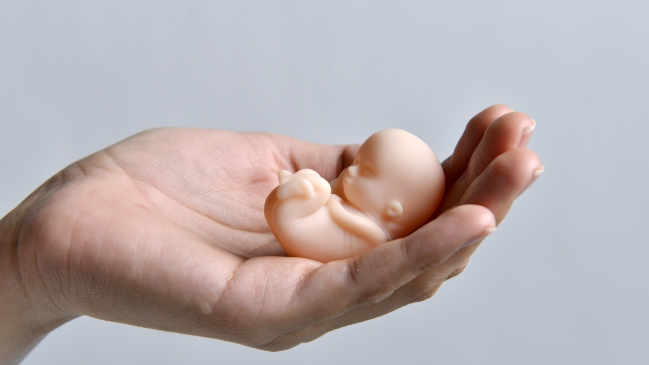 Imagen foto_00000014