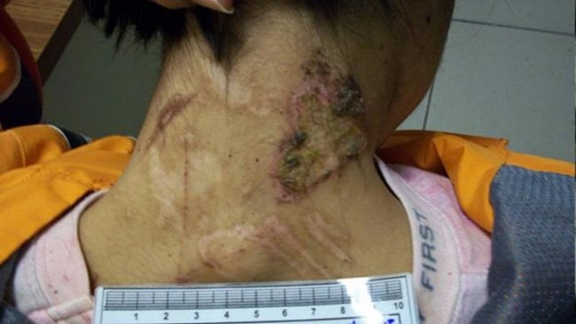 Lo que dos años de esclavitud le hicieron a una joven en México