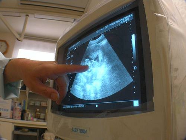 Imagen foto_00000014