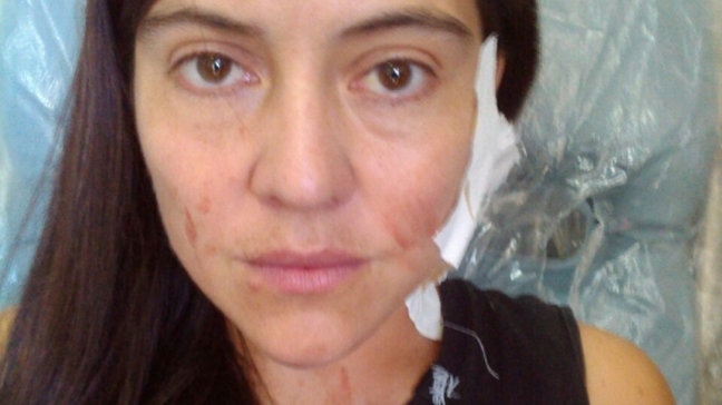 Mujer chilena fue apuñalada durante asalto en Brasil