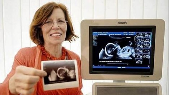 Mujer de 65 años tuvo cuatrillizos en Alemania