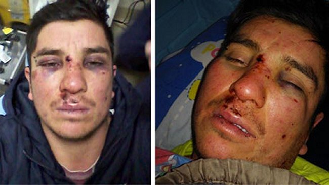 Movilh denunció que guardias de un pub dieron golpiza homofóbica a un estilista