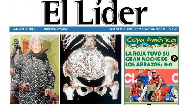 Mujer con feto momificado: Por ser pobre nadie me quiso ayudar