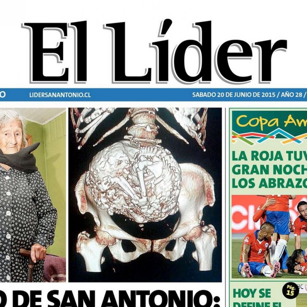 Mujer con feto momificado: Por ser pobre nadie me quiso ayudar