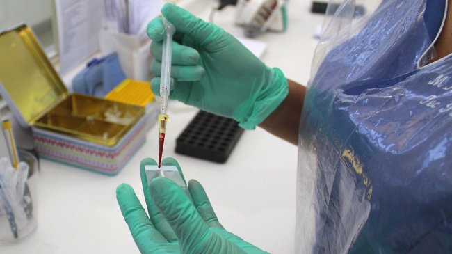 Minsal investiga posible caso fatal de hanta en Puerto Montt