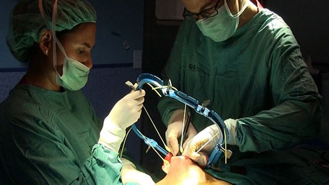 Médicos chinos implantan con éxito un esternón fabricado con impresora 3D