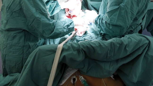 Trasplantan un cráneo impreso en 3D a una niña con hidrocefalia