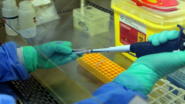 Conscripto que dio positivo en test de virus hanta falleció