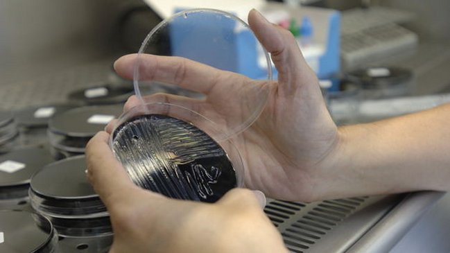 Brote de legionelosis en Nueva York dejó 10 muertos y 108 afectados