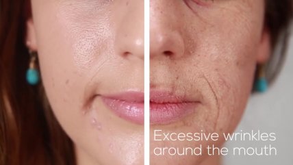 Los efectos del tabaquismo en el rostro de las personas