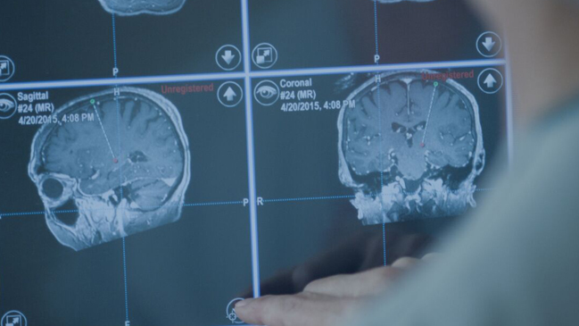 National Geographic emitirá por primera vez una operación a cráneo abierto