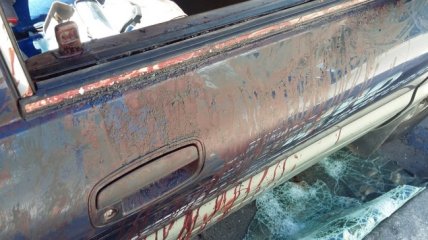   El testimonio de uno de los heridos en incidentes entre hinchas de Colo Colo y Wanderers 