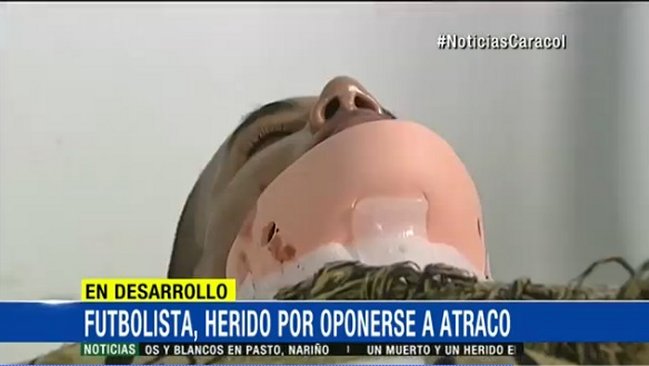 Futbolista colombiano recibió disparo en el cuello y quedó parapléjico