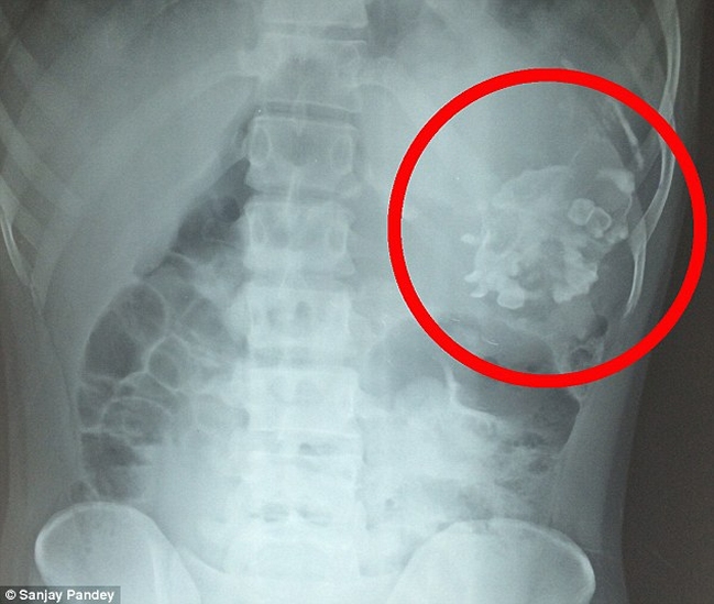 Imagen foto_00000001