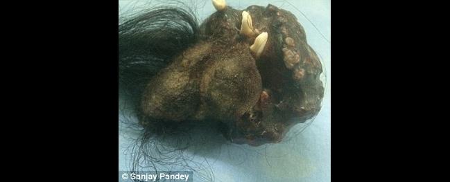 Imagen foto_00000002