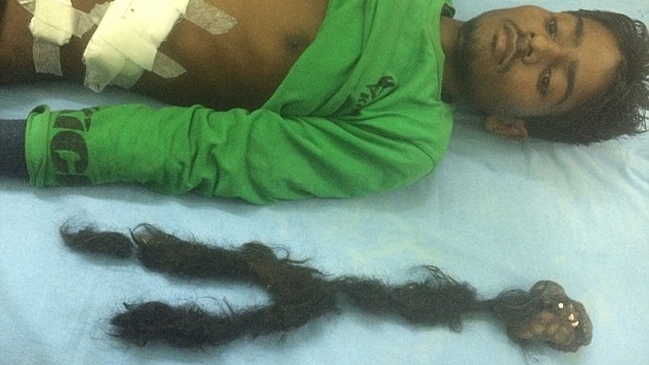 El repulsivo hallazgo al interior del cuerpo de un joven indio