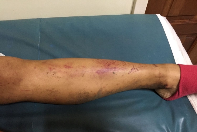 Imagen foto_00000003