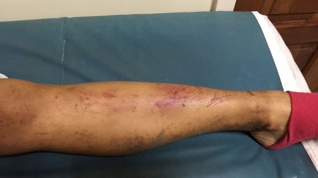 Pareja fue atacada por 