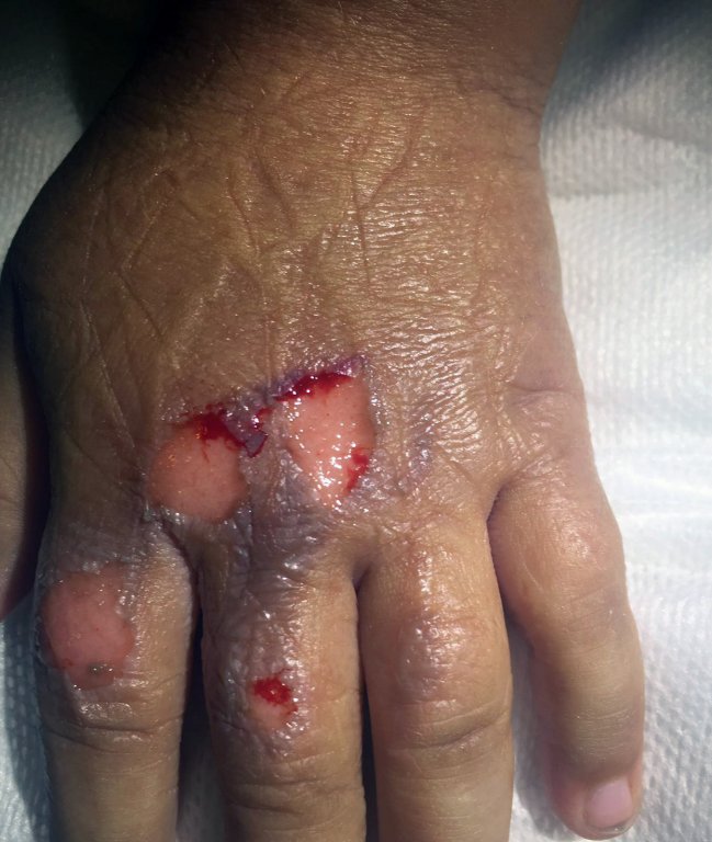 Imagen foto_00000002