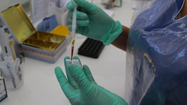 En la Región del Maule se confirmaron primeros casos de hanta de 2016