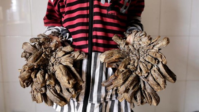 Hospital de Bangladesh se prepara para operar al 