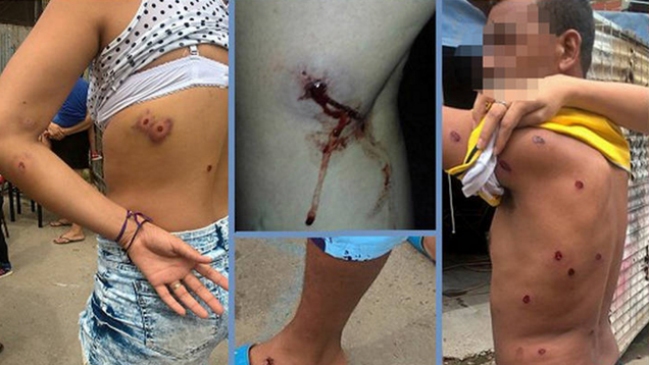 Investigan si policías argentinos dispararon a niños en ensayo de carnaval