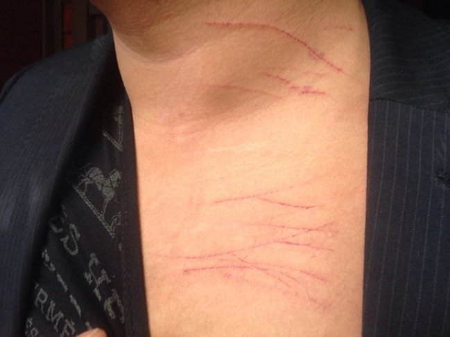 Imagen foto_00000015