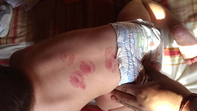 Sename interpuso querella por mordeduras a bebé de un año