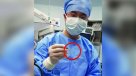 Un joven chino recuperó la vista tras un trasplante de una córnea de cerdo